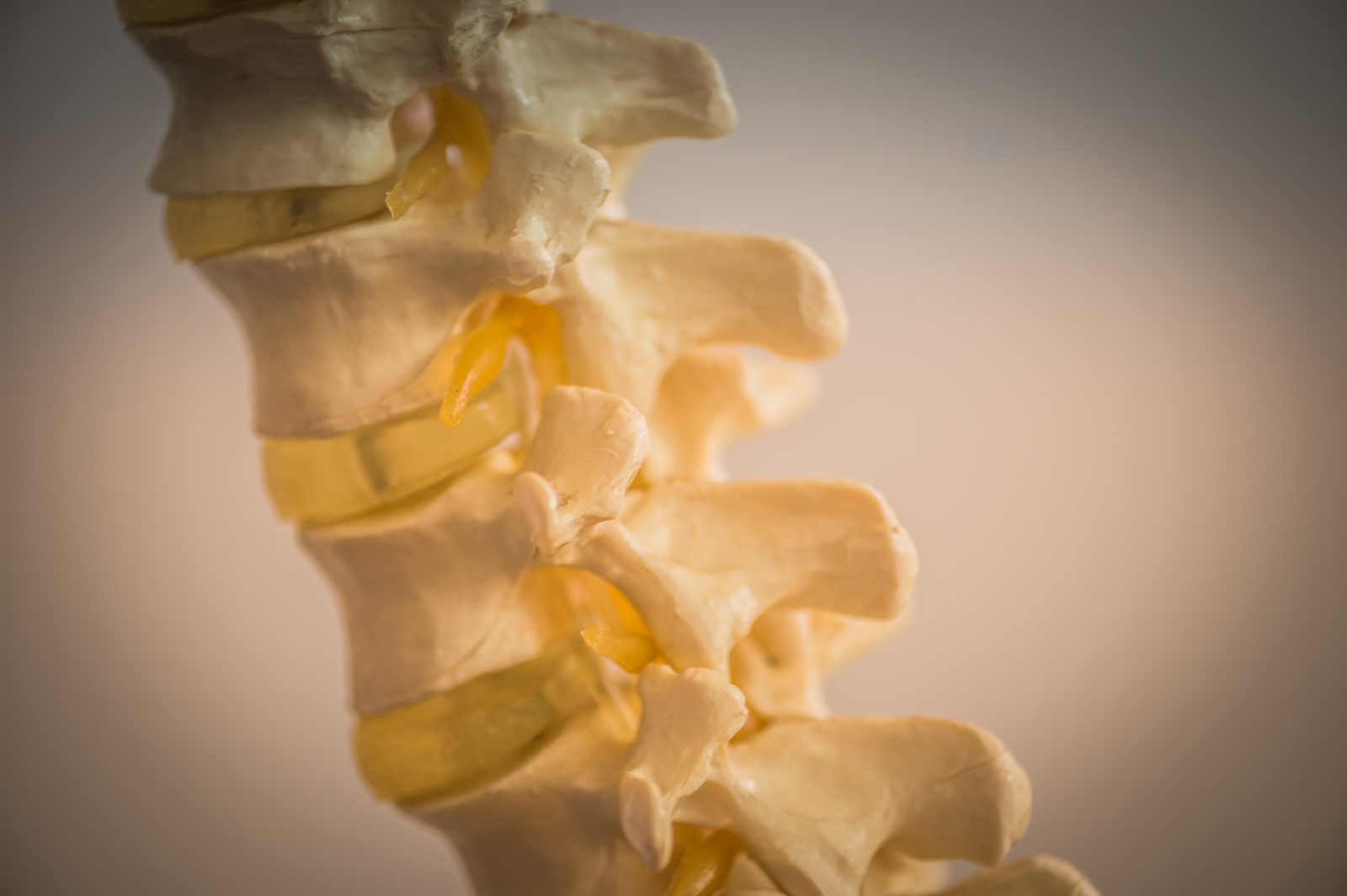 Prolapsed Spinal disc – recovery with BSR
